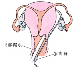 夫妻备孕检查挂什么科